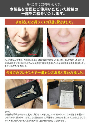 【楽天1位★無料ラッピング】美顔ローラー 美顔器 リフトアップ 【微弱電流】【防水仕様】【充電不要】 小顔ローラー 美顔ローラー メンズ マイクロカレント 美顔器 ローラー 全身用 ローラー 美容グッズ 美容 グッズ 氷ローラー 女性 男性 誕生日 敬老の日 母の日 誕生日